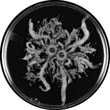E. coli sample