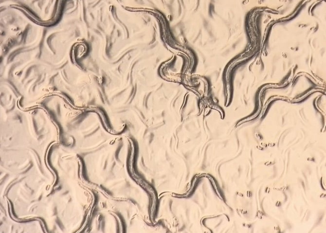 Microscope view of Caenorhabditis elegans roundworms